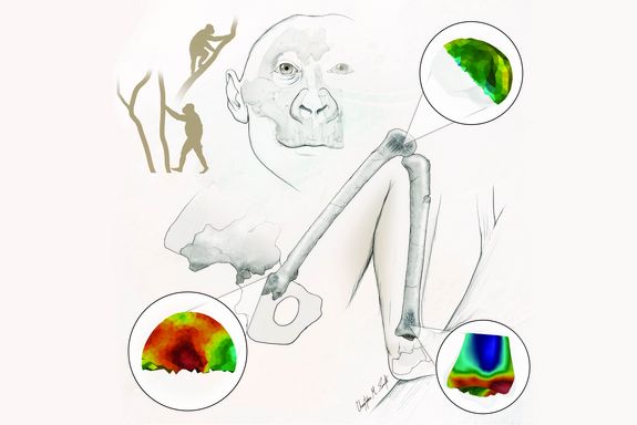 Eine Zeichnung von Knochen, dazu wissenschaftliche Graphiken, die Details dreier Knochenausschnitte zeigen